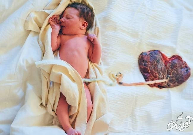 زایمان به روش لوتوس بند ناف و جفت